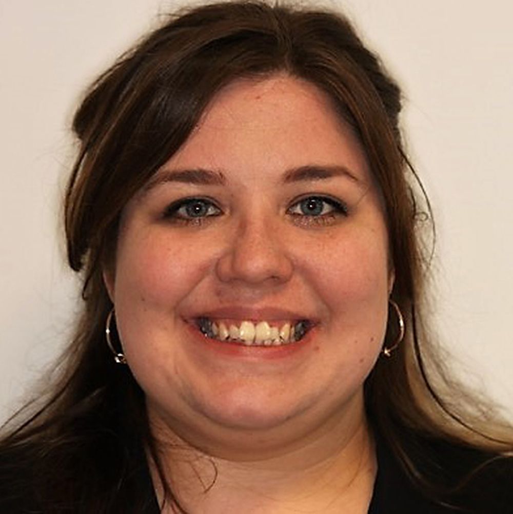 meagan ní chuirc invisalign before